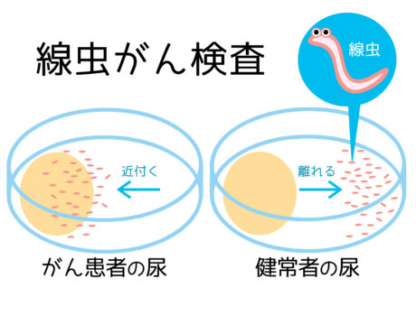 線虫のがん検査が実用化