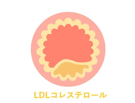 高脂血症と対策