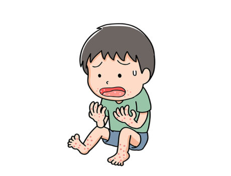 手足口病が流行の兆し