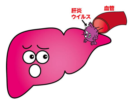 C型肝炎治療薬ハーボニーは100％ではない？