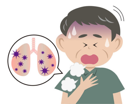 MERS（中東呼吸器症候群）の予防薬を京都府立大グループが作成